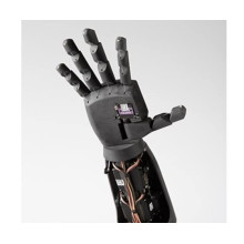 Techno-Tirupati; Robotic Prosthetic Hand | Full DIY Kit